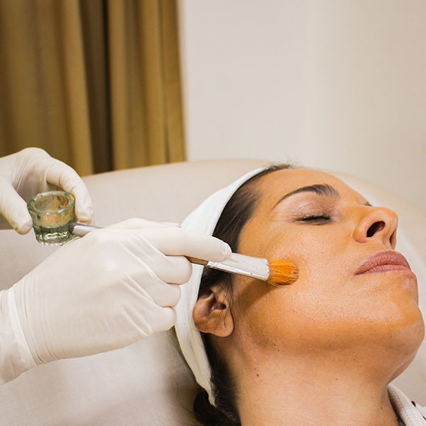 peeling_quimico_elisa