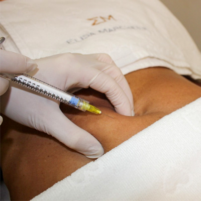 bioestimuladores-de-colageno-corporal_servicos_elisa_v1